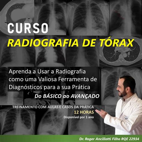 Curso De Radiografia De TÓrax Roger Vinicius Ancillotti Filho Hotmart