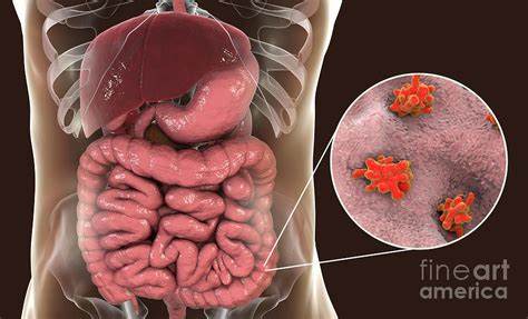 Parasitic Amoeba In Large Intestine Photograph By Kateryna Konscience Photo Library Pixels