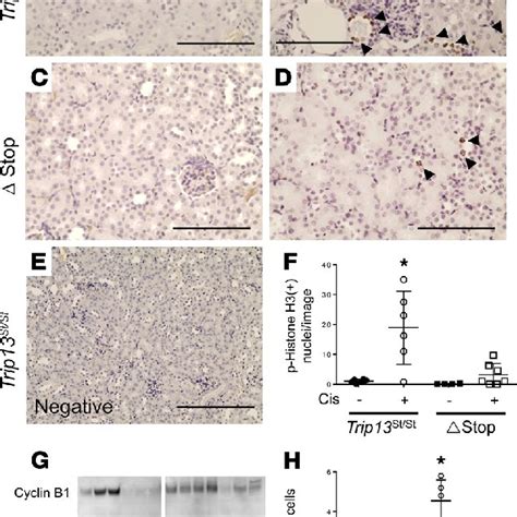 Constitutive TRIP13 Overexpression Reduces Apoptotic Signaling And