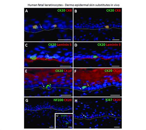 Immunofluorescence Staining Demonstrating The Presence Of Human Merkel