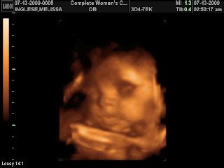 The Inglese Family: Baby Boy 3D/4D Ultrasound Take #1