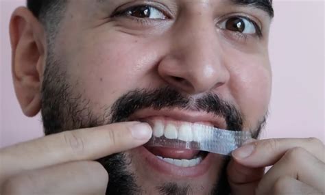 How do teeth whitening strips differ from in-chair teeth whitening ...