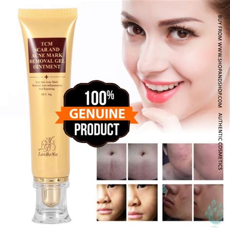 Lanbena Acne Scar Removal Cream Skin Repair Face Cream Acne Spots Acne ...