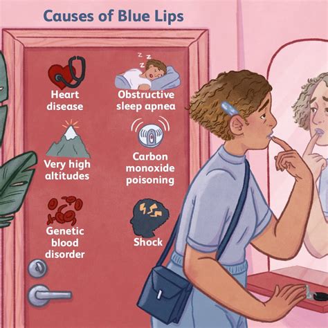 Can Blue Lips Be A Sign Of Anemia