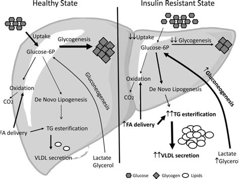 Pathway Selective Insulin Resistance And Metabolic Disease The