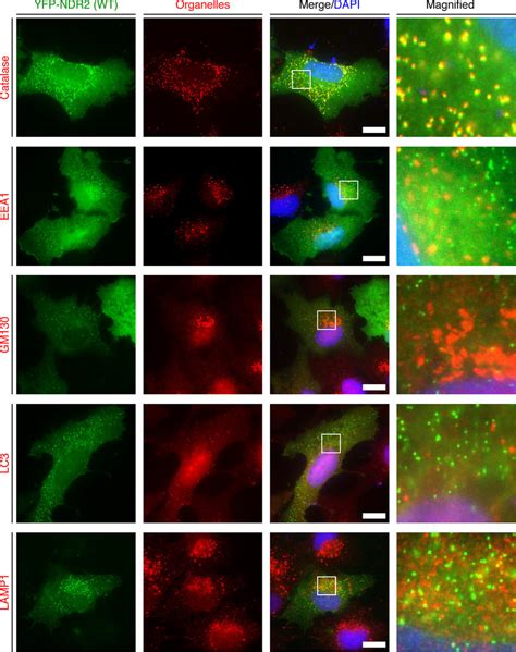 NDR2 Co Localizes With Catalase RPE1 Cells Were Transfected With The