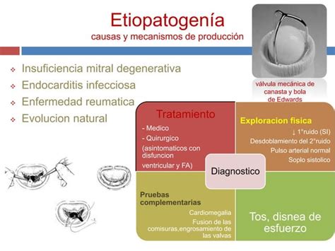 Valvulopat A Mitral Y Tric Spide Ppt