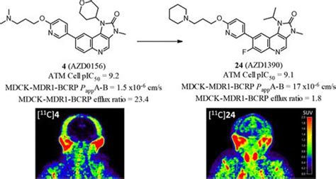 Identification Of Novel Selective Ataxia Telangiectasia Mutated Kinase