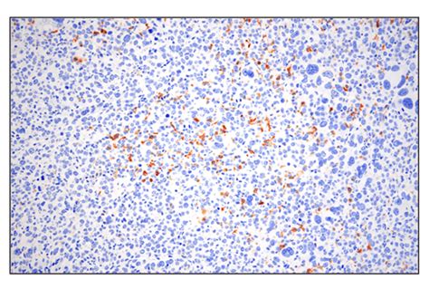 Phospho SLP 76 Ser376 E3G9U XP Rabbit MAb BSA And Azide Free