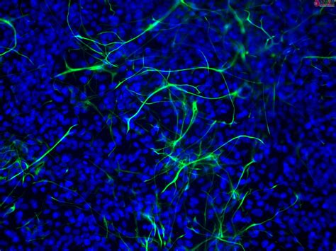 IPSC Derived Human Neural Stem Cells IPSC HNSC