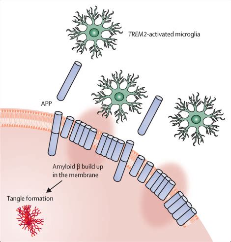 TREM2 Mediated Activation Of Microglia Breaks Link Between Amyloid And