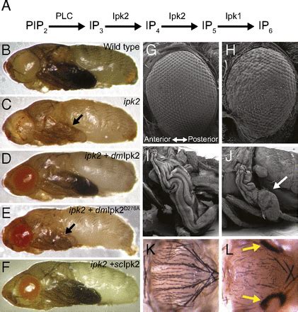 Inositol Phosphate Kinase Is Required For Imaginal Disc Development