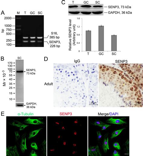 Expression Dynamics Of Senp In Sertoli And Germ Cells In Mouse Testis