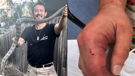 Tiger Snake Bite Hospitalises Melbournes Snake Hunter The Senior