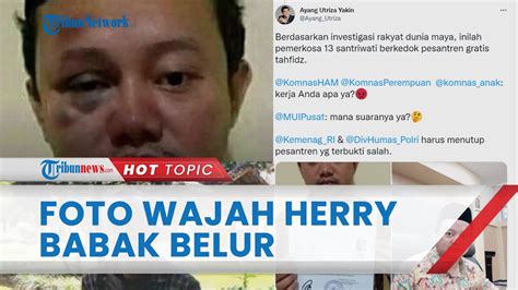 Penampakan Wajah Herry Wirawan Pemerkosa Belasan Santriwati Babak Belur