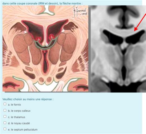 Neuro Anatomie A1 S1 Chap 9 Flashcards Quizlet