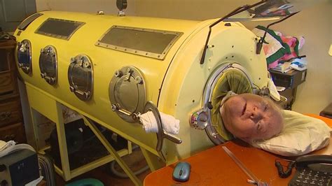 Is The Man In The Iron Lung Still Alive 2024 Aurel Caresse