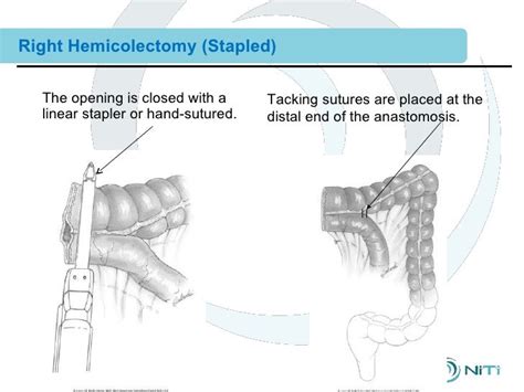 Combined 12 Clinical Training Surgical Procedures