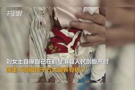 【河南】女子曝医院剖腹产致新生儿骨折，现在两腿骨节长度不同，院方：希望走医调委解决 骨节 院方 两腿