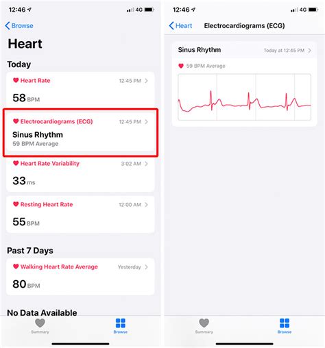 How to Use Apple Watch ECG Feature Effectively | Beebom