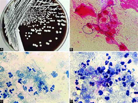 Phenotype Identification Of Nocardia Species A Colonies Of Nocardia