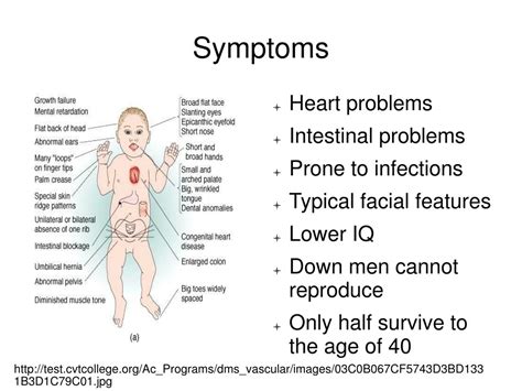 Ppt Chromosome Disorders Numerical Abnormalities Powerpoint