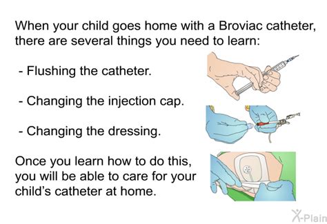 PatEdu.com : Broviac Central Line Care - Pediatrics