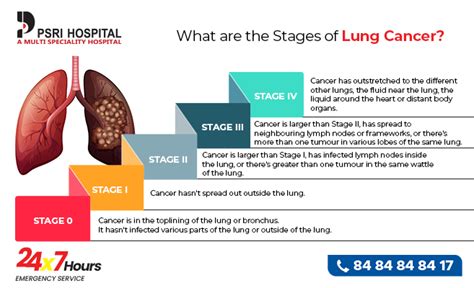 What are the Stages of Lung Cancer? - Social Social Social | Social ...