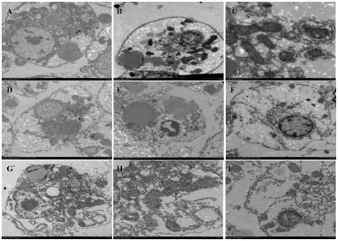 The Ultrastructure Of Primary Hepatocytes Download Scientific Diagram