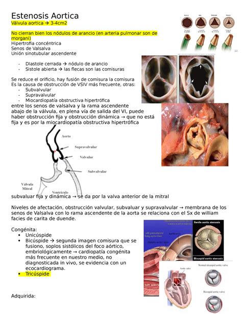 Estenosis Aortica Definici N Estenosis Aortica V Lvula Aortica