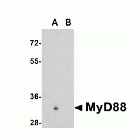 Myd Antibody Bsa Free Novus Biologicals Mg Unlabeled