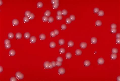 Corynebacterium - wikidoc