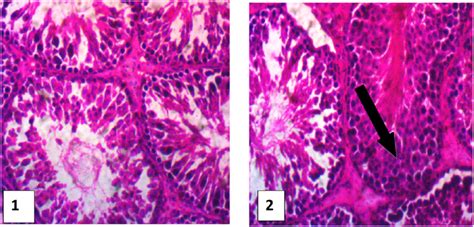 Histological Examination Of The Testis Group 1 Control No Lesion