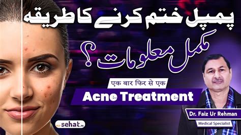 Pimple Khatam Karne Ka Tarika How To Remove Pimples Acne Treatment