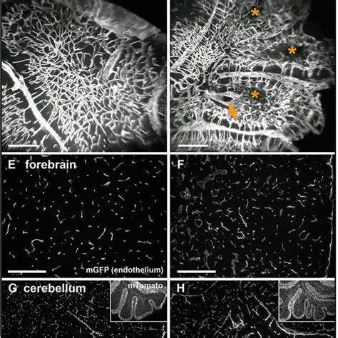 Endothelial Deletion Of Rbpj From Birth Results In Large Irregular