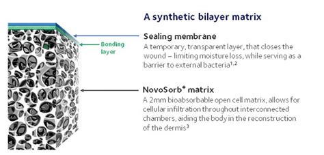 What Is Novosorb® Btm