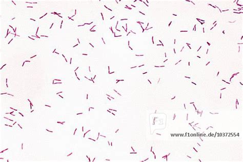 Bacteria Legionella pneumophila, a gram-negative bacillus or rod ...