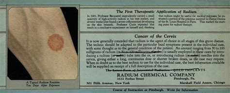 Mütter Medicine Mondays: Radiation and Radium Therapy