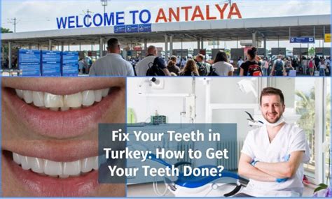 Fix Your Teeth In Turkey Pros Prices And Treatments