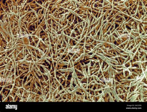 Actinomycete Bacteria Coloured Scanning Electron Micrograph SEM Of