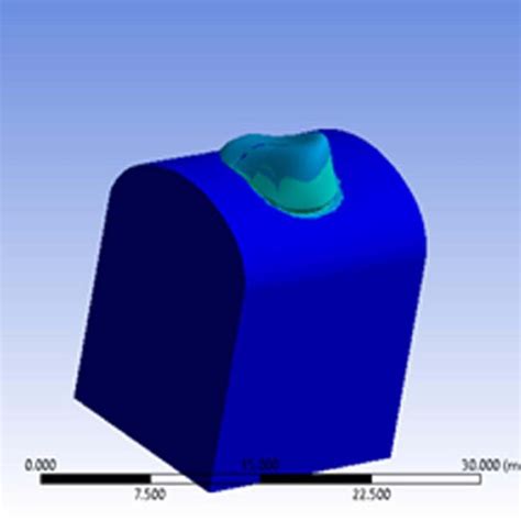 Finite Element Analysis Of Tetric N Ceram Composite Resin Download