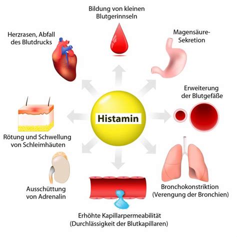 Welche Anzeichen Weisen Auf Eine Histaminintoleranz Hin