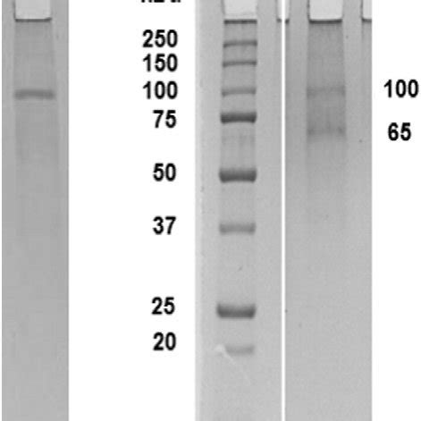 A DEAE Cellulose And B Sepharose CL 6B Chromatographic Profiles For