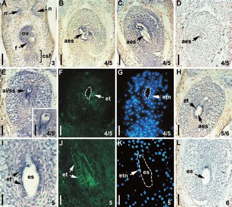 A±l In Situ Analysis Of Hpgluc Expression And Susy Mem Localization In Download Scientific