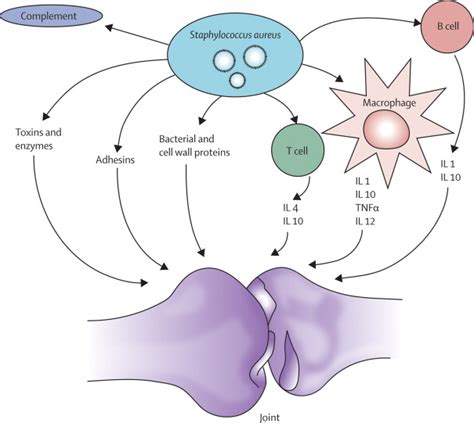 Septic Arthritis Pathophysiology