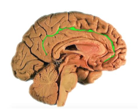 Neuro Lab 5 Pictures Updated Flashcards Quizlet