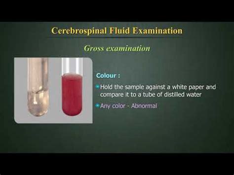 What Do Microbiologists Check For In Csf Fluid