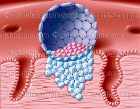 BLASTOCYSTE IMPLANTÉ illustration medicale Sophie Jacopin