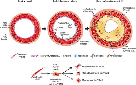 Frontiers Vascular Smooth Muscle Cells In Intimal Hyperplasia An Update