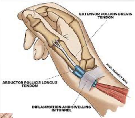 Wrist And Hand Biomechanics Flashcards Quizlet